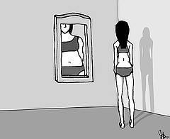 Síntomas de la anorexia